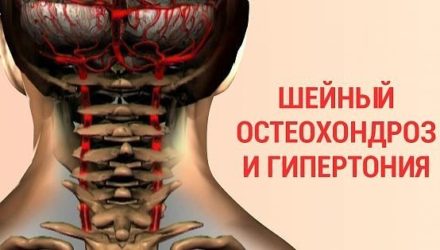 Как победить шейный остеохондроз и гипертонию